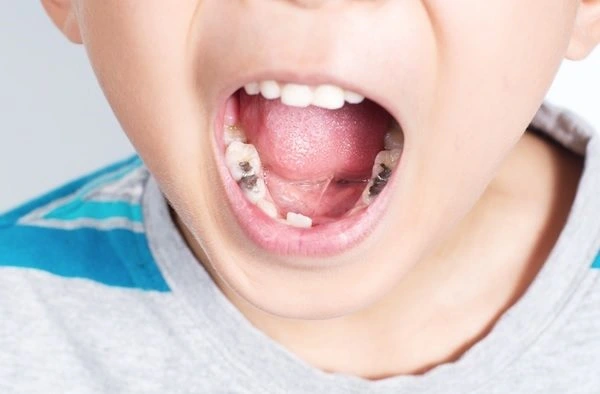 Children´s Dental Services