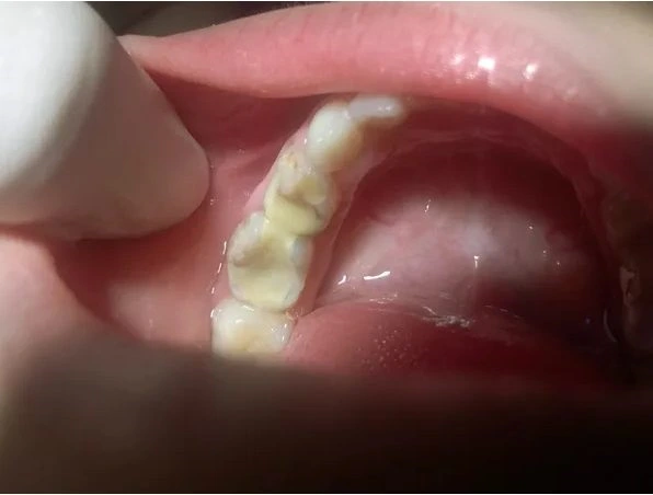 Children´s Dental Services