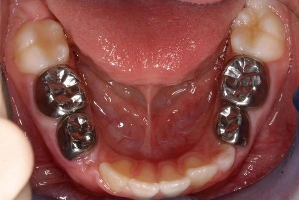 Children´s Dental Services
