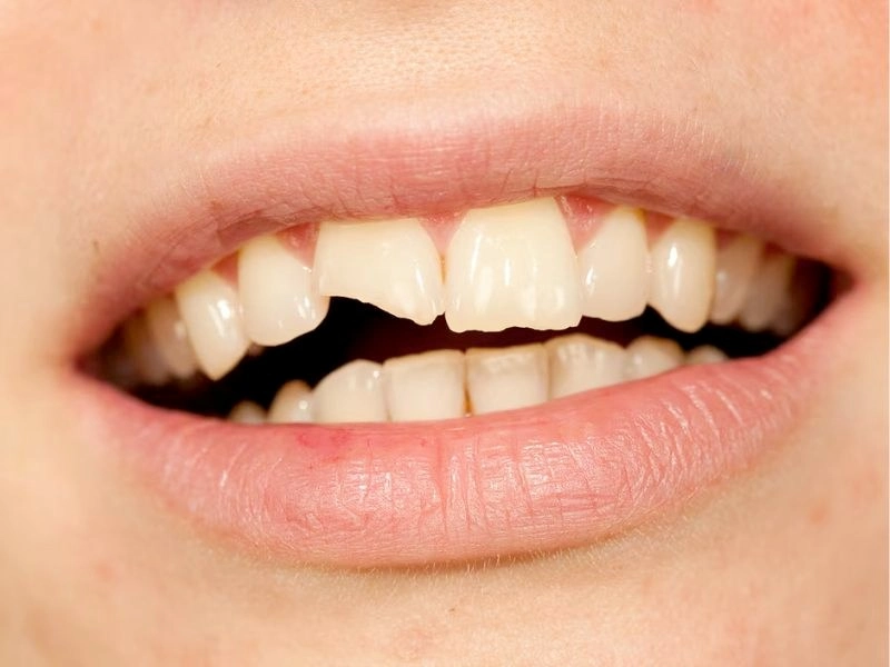 Dental restoration services