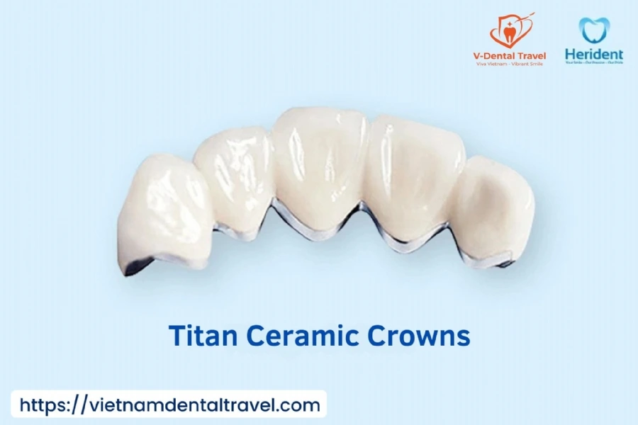 Aesthetic Porcelain Crowns – Brighten Your Smile with Natural-Looking Dental Restorations