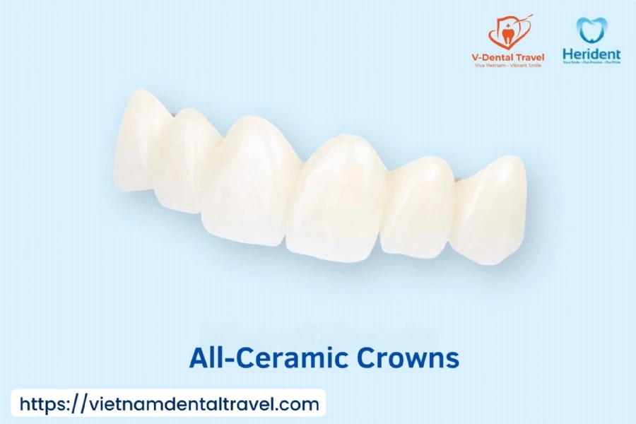 Aesthetic Porcelain Crowns – Brighten Your Smile with Natural-Looking Dental Restorations