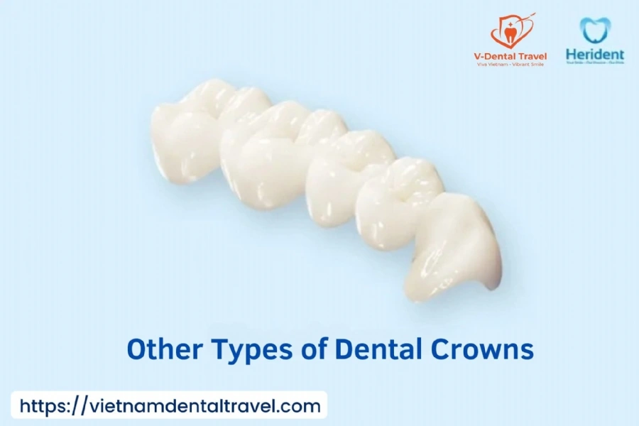 Aesthetic Porcelain Crowns – Brighten Your Smile with Natural-Looking Dental Restorations