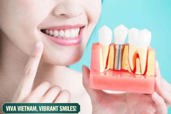 Disadvantages of Dental Implants – Top 5 Limitations You Should Know