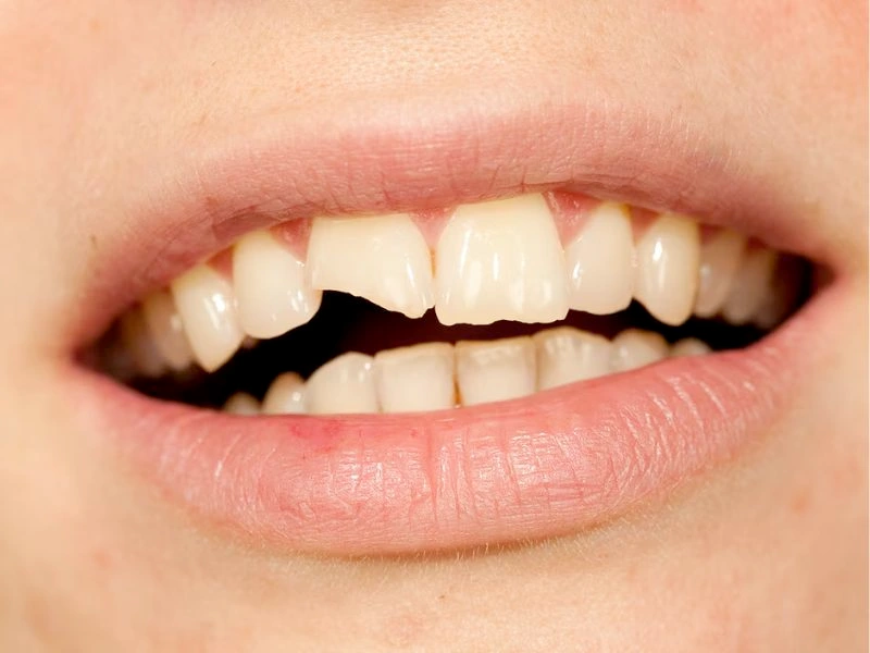 Dental restoration services
