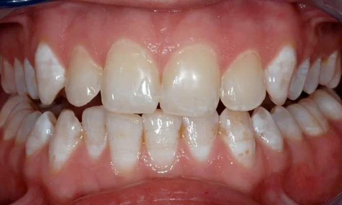 Dental restoration services