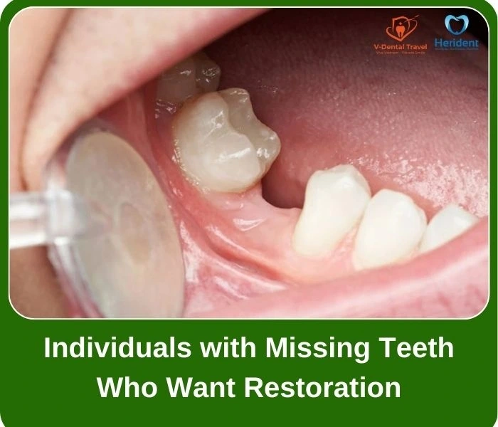 Dental Implant Service