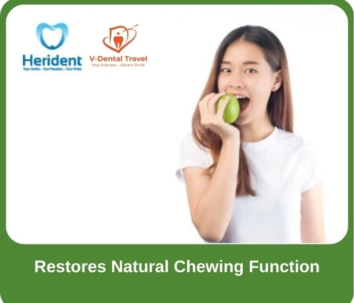 Dental Implant Service
