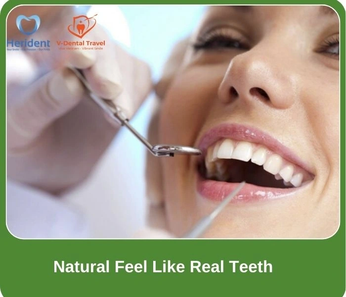 Dental Implant Service