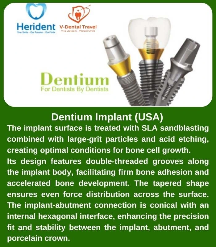 Dental Implant Service
