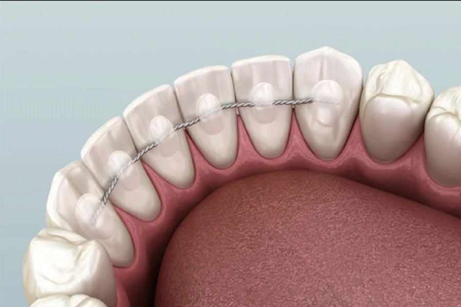 Understanding Periodontology – Causes, Risks, and Treatments for Gum Disease