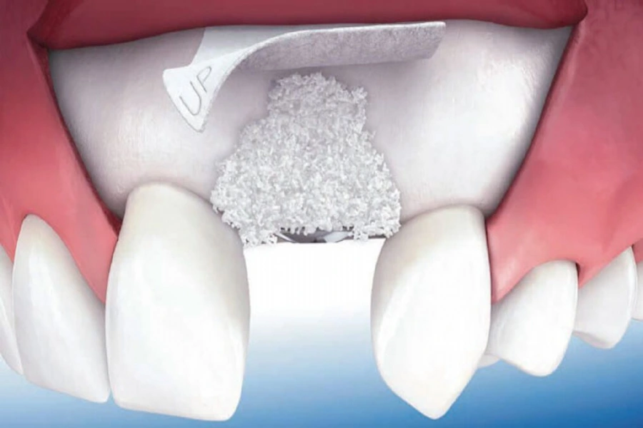 Understanding Periodontology – Causes, Risks, and Treatments for Gum Disease