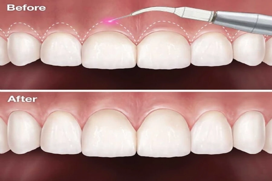 Understanding Periodontology – Causes, Risks, and Treatments for Gum Disease