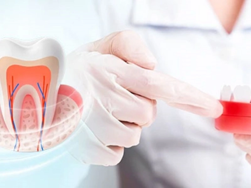 Understanding Periodontology – Causes, Risks, and Treatments for Gum Disease