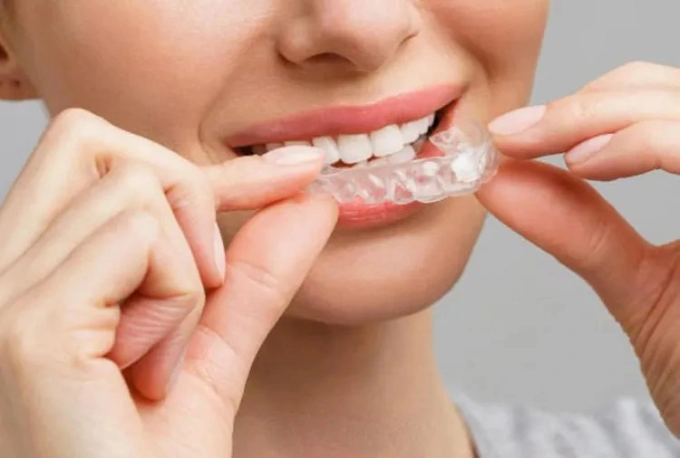 What is Teeth Whitening